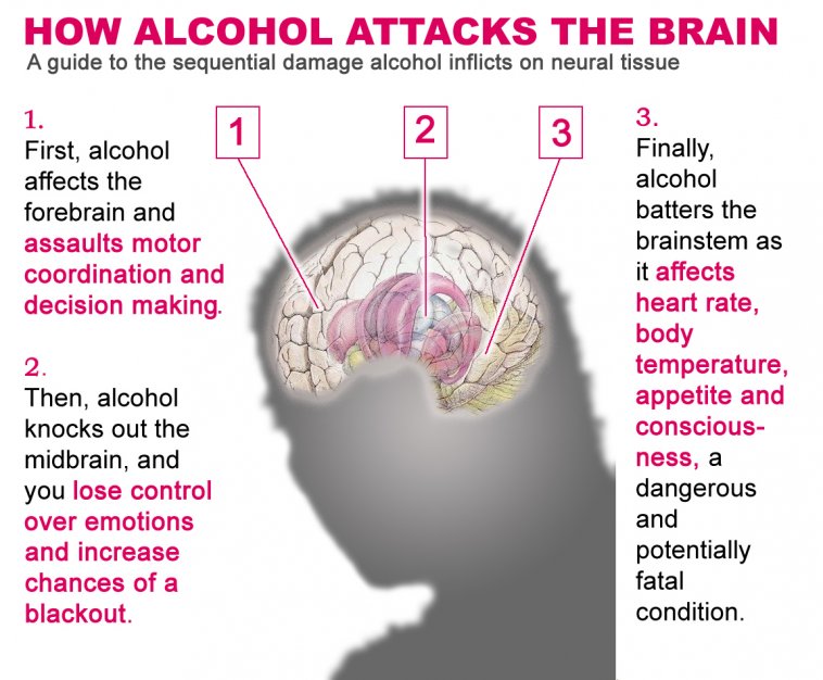 *******-brain.jpg